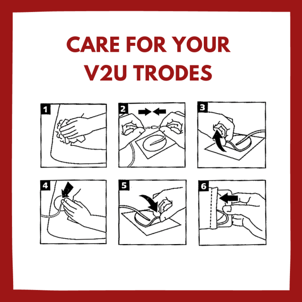 Electrodes (V2U Trode) - Image 3